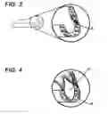 Fig. 03 - Mouth Protector Adhesion Method