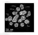 Fig. 05 - Hollow metal nanoparticles