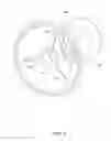 Fig. 06 - Attachment for a spraying device for use in small places with evacuation of particulates