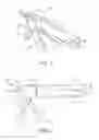 Fig. 02 - Device for holding and dispensing viscous material