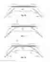 Fig. 09 - Methods for manufacturing ultrasound transducers and other components
