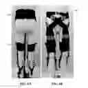 Fig. 07 - Soft exosuit for assistance with human motion