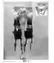 Fig. 08 - Soft exosuit for assistance with human motion