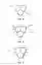 Fig. 04 - Device and system for treating hair and/or skin