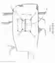 Fig. 31 - Railcar coupler core with vertical parting line and method of manufacture