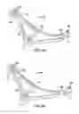 Fig. 19 - Vehicle front suspension
