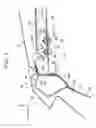 Fig. 08 - Vehicle upper structure