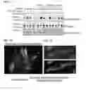 Fig. 13 - COMPOSITIONS AND METHODS FOR TREATING NEURODEGENERATIVE DISEASES AND CARDIOMYOPATHY