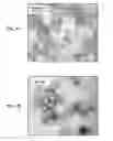 Fig. 04 - Immunogenic bacterial vesicles with outer membrane proteins