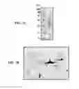 Fig. 08 - Immunogenic bacterial vesicles with outer membrane proteins