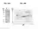 Fig. 11 - Immunogenic bacterial vesicles with outer membrane proteins
