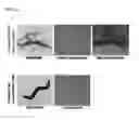 Fig. 14 - Fusion proteins, recombinant bacteria, and methods for using recombinant bacteria