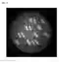 Fig. 16 - Fusion proteins, recombinant bacteria, and methods for using recombinant bacteria