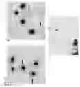 Fig. 17 - Fusion proteins, recombinant bacteria, and methods for using recombinant bacteria