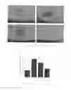Fig. 04 - Compositions And Methods For Macular Degeneration