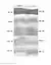 Fig. 08 - VEGF-SPECIFIC ANTAGONISTS FOR ADJUVANT AND NEOADJUVANT THERAPY AND THE TREATMENT OF EARLY STAGE TUMORS