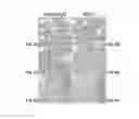 Fig. 16 - VEGF-SPECIFIC ANTAGONISTS FOR ADJUVANT AND NEOADJUVANT THERAPY AND THE TREATMENT OF EARLY STAGE TUMORS