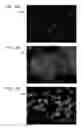Fig. 13 - Antitumor peptide derived from a complementarity determining region of a humanized monoclonal antibody to NAP12B transporter