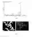 Fig. 04 - Transition metal based pro-catalyst and a process for its preparation