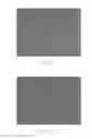 Fig. 02 - Culture medium and method for inducing differentiation of pluripotent stem cells into neuroepithelial cells
