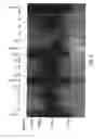Fig. 04 - DNA POLYMERASES AND MUTANTS THEREOF