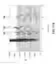 Fig. 117 - CELLULOLYTIC ENZYMES, NUCLEIC ACIDS ENCODING THEM AND METHODS FOR MAKING AND USING THEM