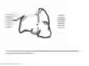 Fig. 11 - NOVEL METALLOPROTEASES
