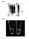 Fig. 03 - Surface display of functional proteins in a broad range of gram negative bacteria