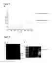 Fig. 11 - Surface display of functional proteins in a broad range of gram negative bacteria