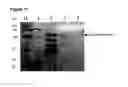 Fig. 12 - Surface display of functional proteins in a broad range of gram negative bacteria