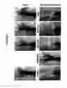 Fig. 05 - HERBICIDE-TOLERANT PLANTS