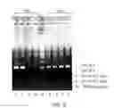 Fig. 19 - PRIMERS AND METHODS FOR THE DETECTION AND DISCRIMINATION OF NUCLEIC ACIDS