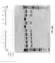 Fig. 28 - Compositions and methods of nucleic acid-targeting nucleic acids