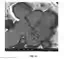 Fig. 15 - Methods of producing a titanium product