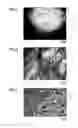 Fig. 04 - Ni-based heat-resistant superalloy and method for producing the same
