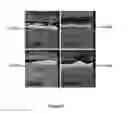 Fig. 07 - Chromium-Aluminum Binary Alloy Having Excellent Corrosion Resistance and Method of Manufacturing Thereof