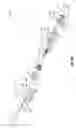 Fig. 05 - THREAD TENSIONER FOR A SEWING MACHINE