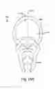 Fig. 22 - Press fit storm window system