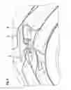 Fig. 05 - Gate having an insulating curtain
