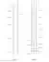 Fig. 08 - Sliding sleeve for stimulating a horizontal wellbore, and method for completing a wellbore