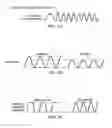 Fig. 04 - System and method for dual telemetry acoustic noise reduction