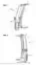 Fig. 02 - Vertical air intake system; air cleaner; and filter element
