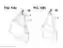 Fig. 02 - Hook