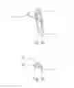Fig. 03 - Spring-Based Disc Brake Pad Cushions