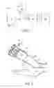 Fig. 02 - Liner retaining feature for a combustor