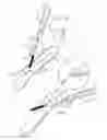 Fig. 03 - Removable pin with insertion aperture