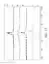 Fig. 20 - Solid state NMR spectroscopy/imaging in situ measuring devices and methods for calibration and determining one or more quantitative properties of a target sample