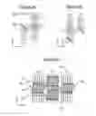 Fig. 04 - Inspection head of an eddy current non-destructive testing sensor and sensor comprising such an inspection head