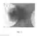 Fig. 06 - Magnetic immunosensor and method of use