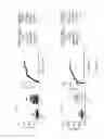 Fig. 03 - Methods for diagnosing and treating bicuspid aortic valve and/or aortopathies